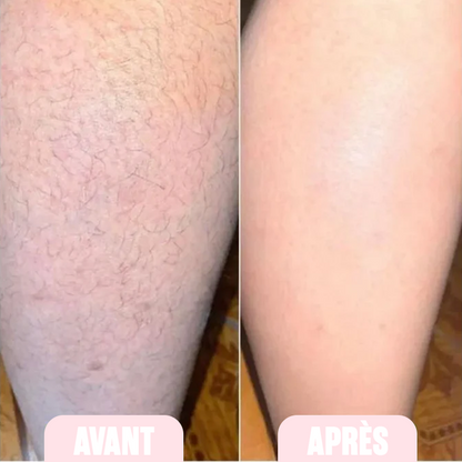 Crystal Hair Eraser - Shave Mate